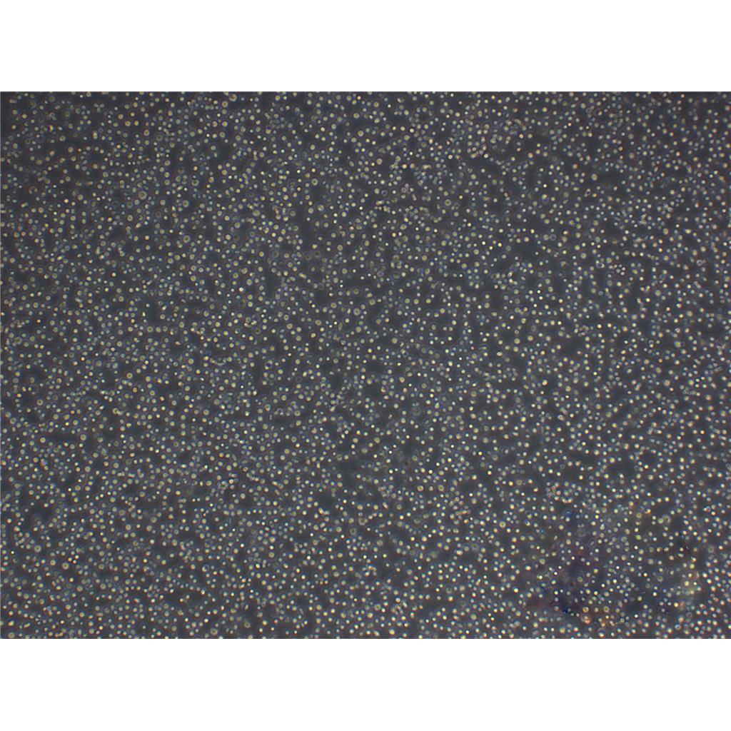 HBL-100人整合SV40基因的乳腺上皮细胞全年复苏|已有STR图谱