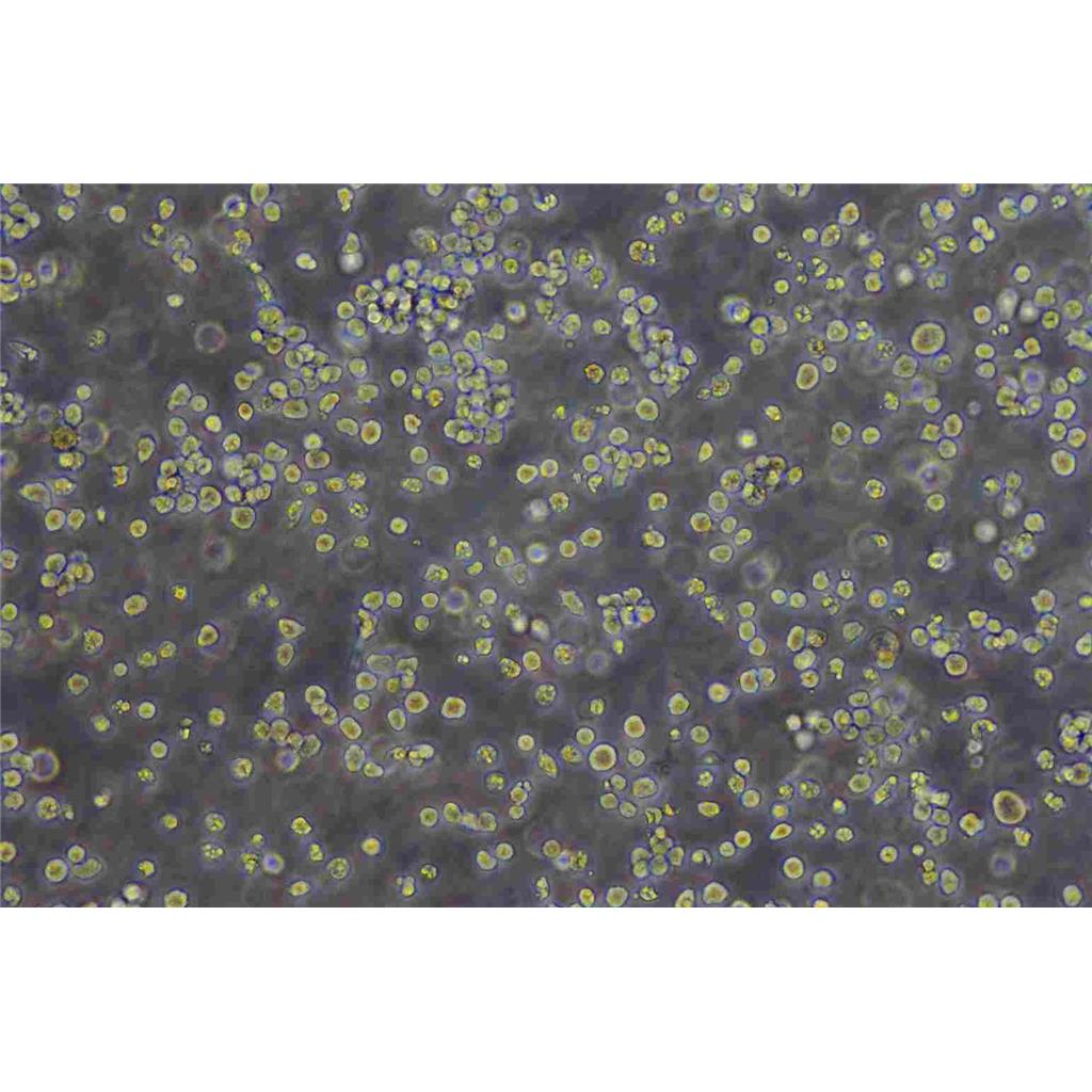 DU 145人前列腺癌细胞全年复苏|已有STR图谱