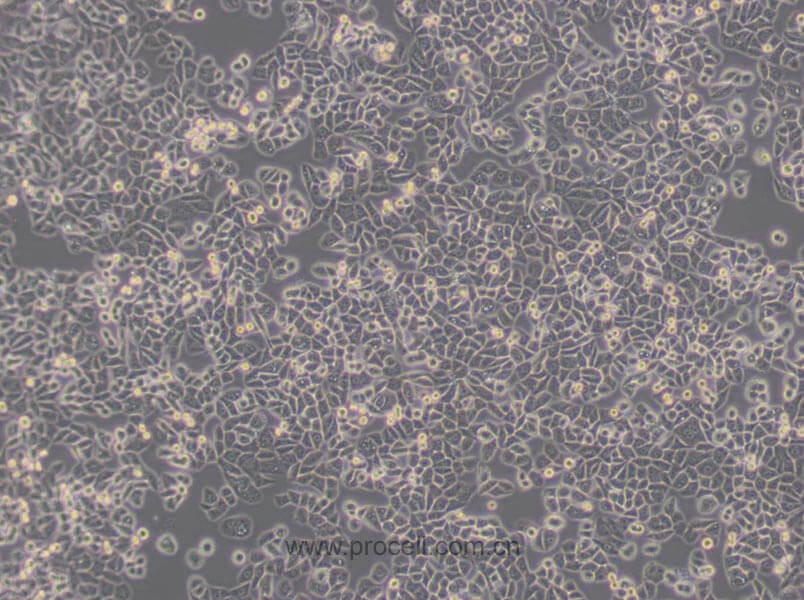 MDA-MB-468细胞 (人乳腺癌细胞) (STR鉴定正确)CL-0290