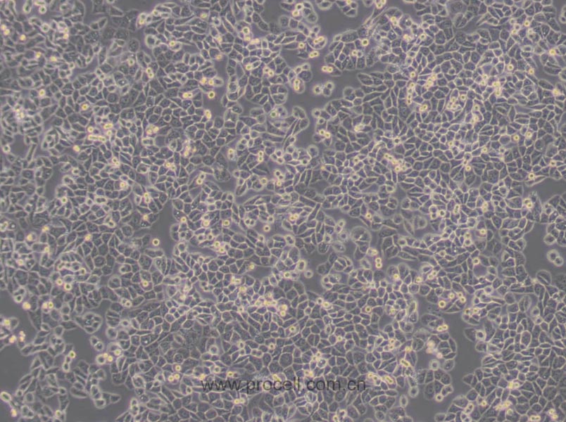 MDA-MB-468细胞 (人乳腺癌细胞) (STR鉴定正确)CL-0290
