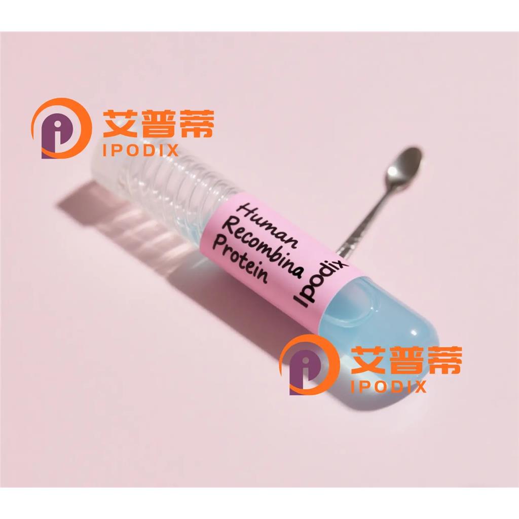 CaMKIIalpha抗体;CaMKIIalpha Antibody—艾普蒂