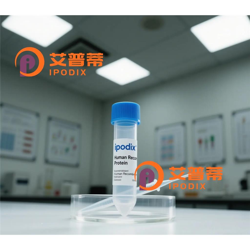 SMCHD1抗体;SMCHD1 Antibody—艾普蒂