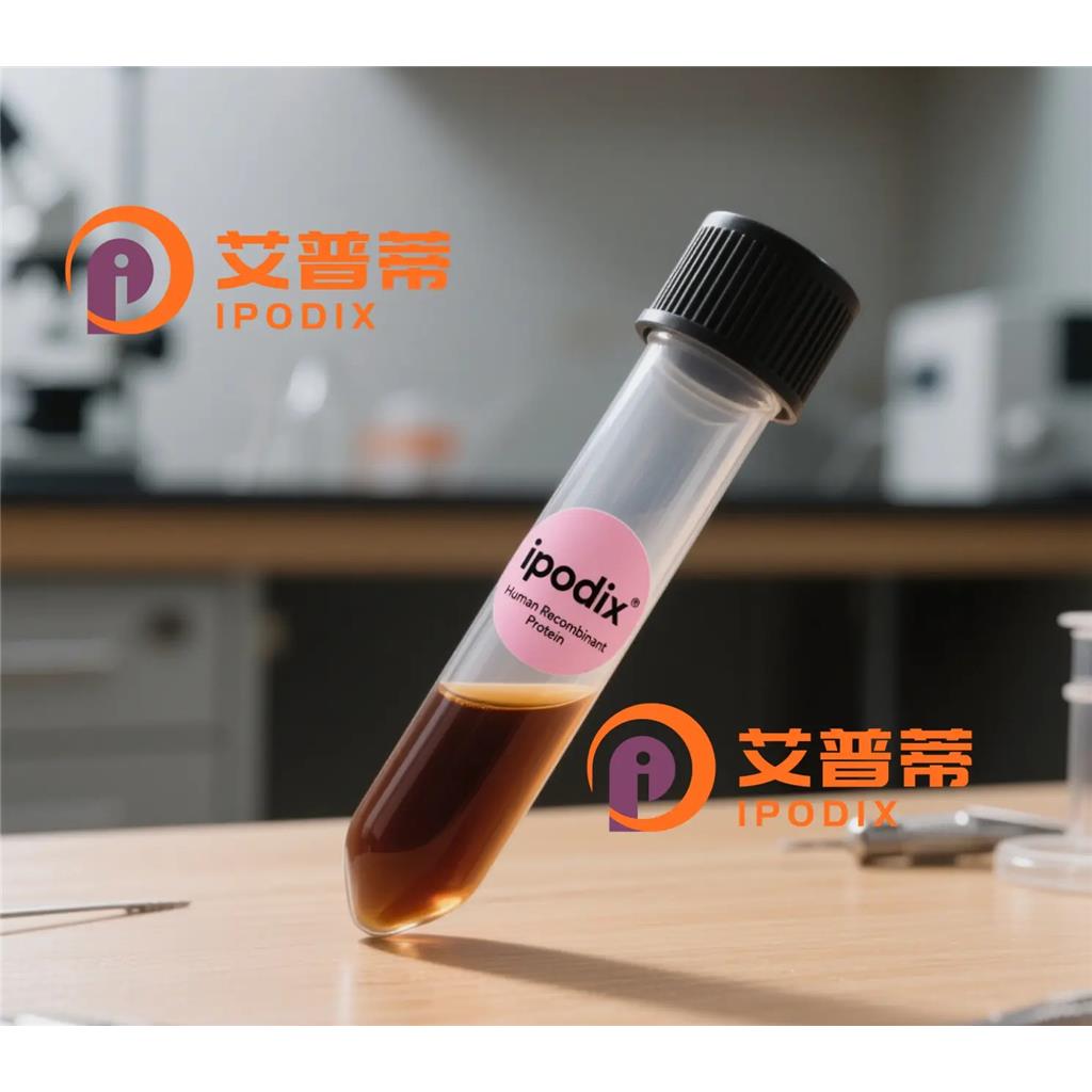 AHCY抗体;AHCY Antibody—艾普蒂