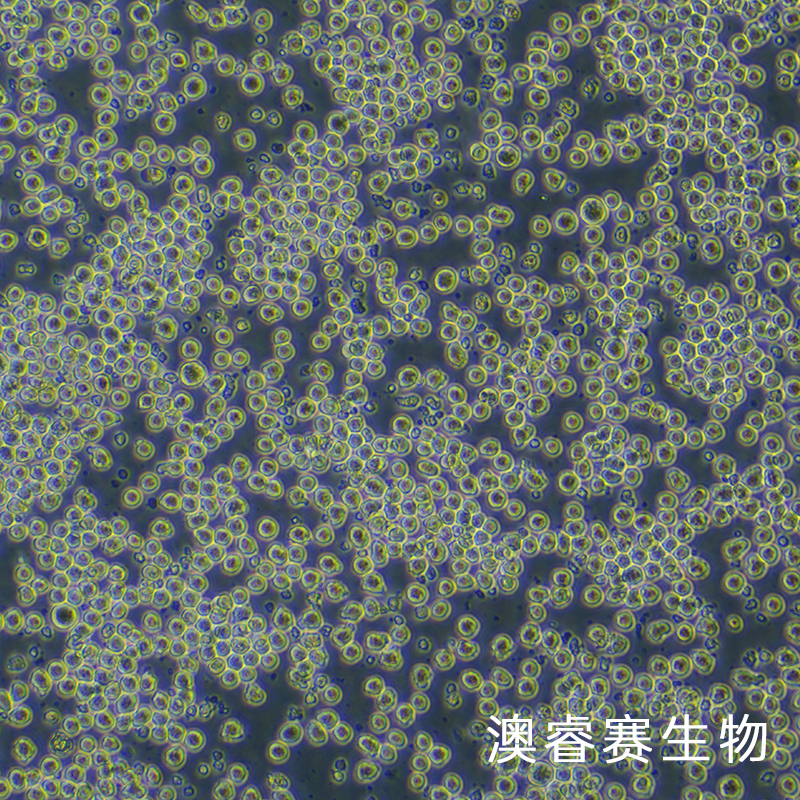 AE-2（小鼠杂交瘤细胞抗AChE）