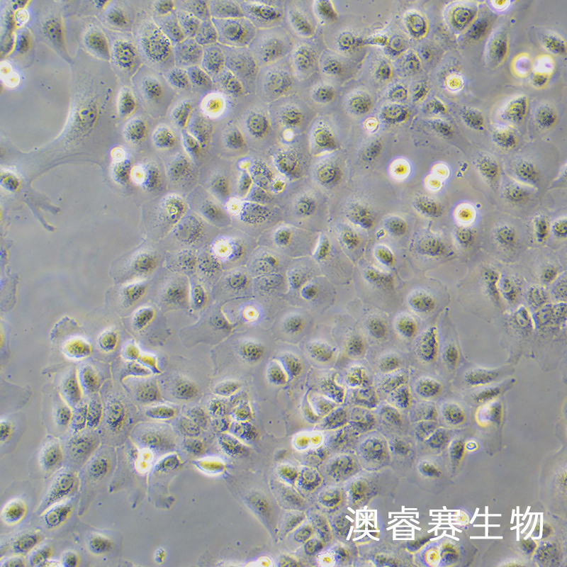 SCC15（人舌鳞癌细胞）