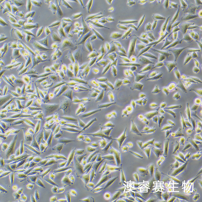 EJ-1（人膀胱癌细胞）