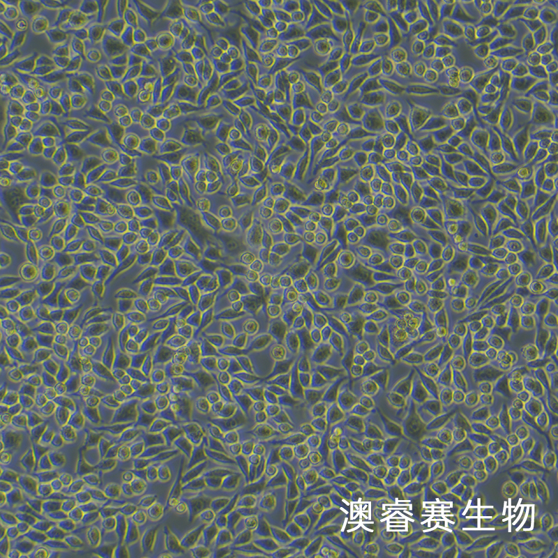 L-WRN（小鼠皮下结缔组织细胞）