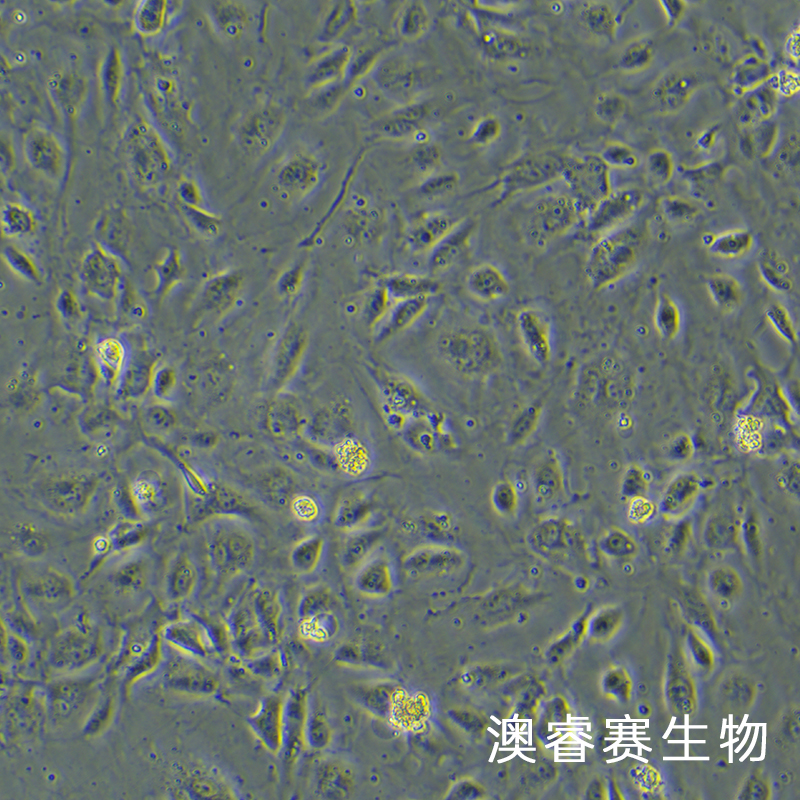 HLEC（人晶状体上皮细胞）
