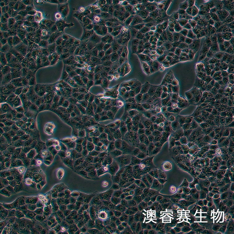 MKU74（人胃癌细胞）