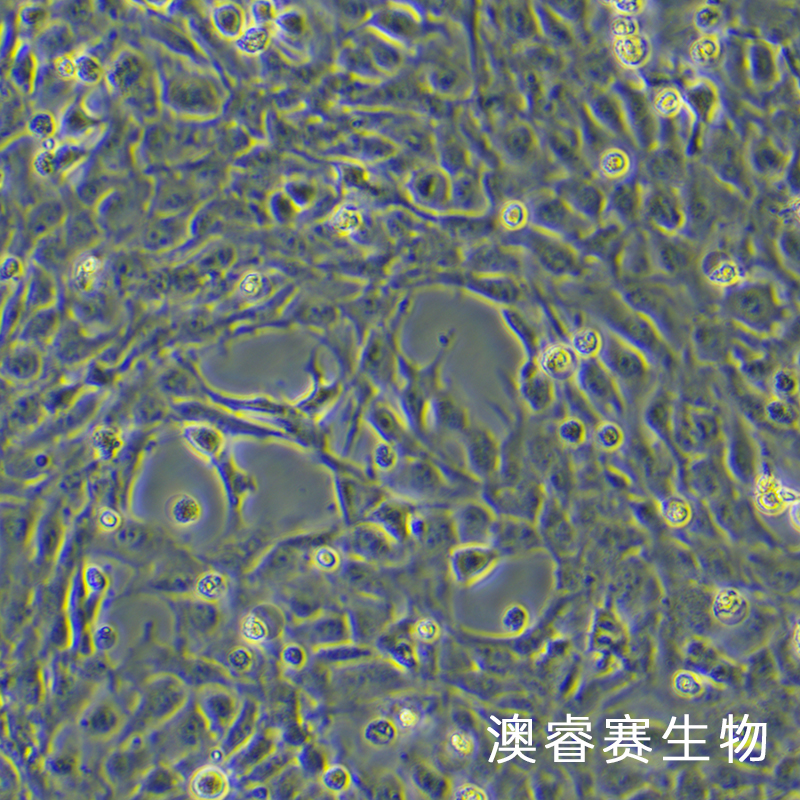 12Z（人源子宫内膜异位细胞）