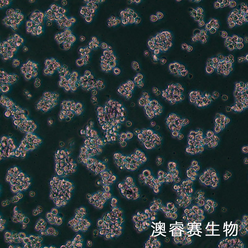TMD8（人弥漫大B淋巴瘤）