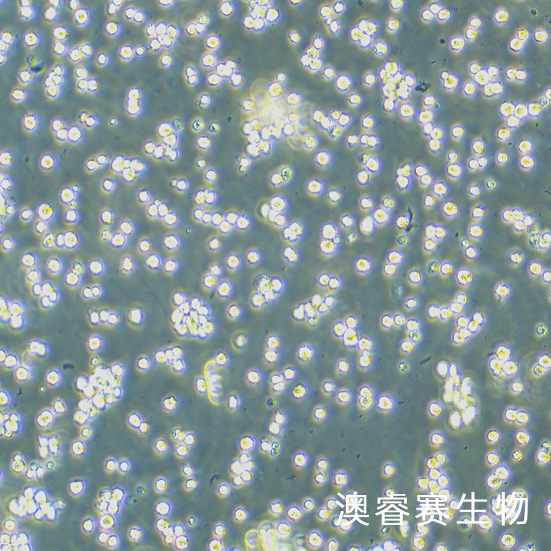SKM-1（人骨髓增生异常综合征细胞）