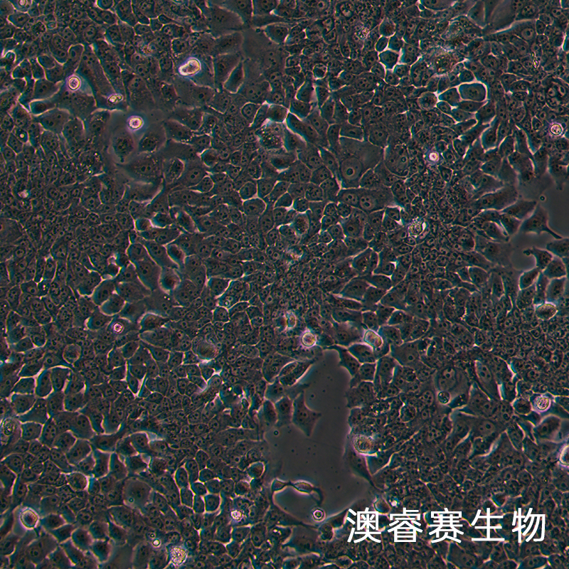 TE-10（人食管癌细胞）