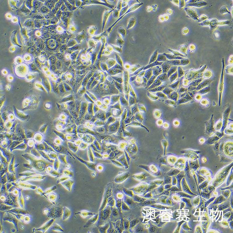 JIMT-1（人乳腺癌细胞）