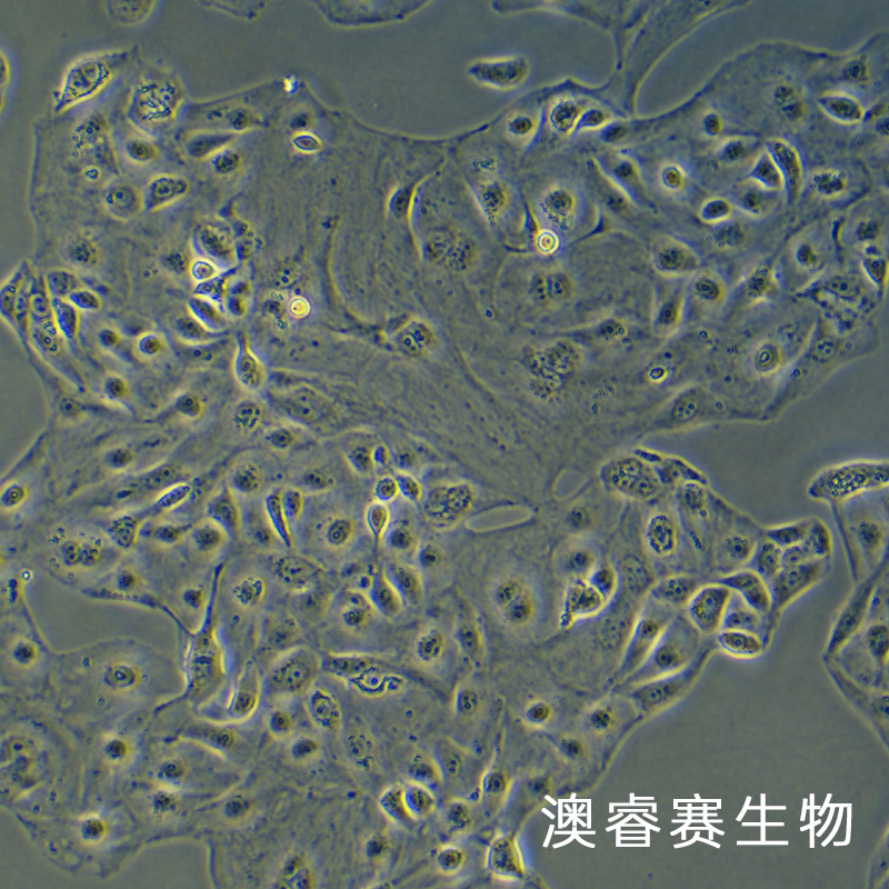 KURAMOCHI（人卵巢癌细胞）