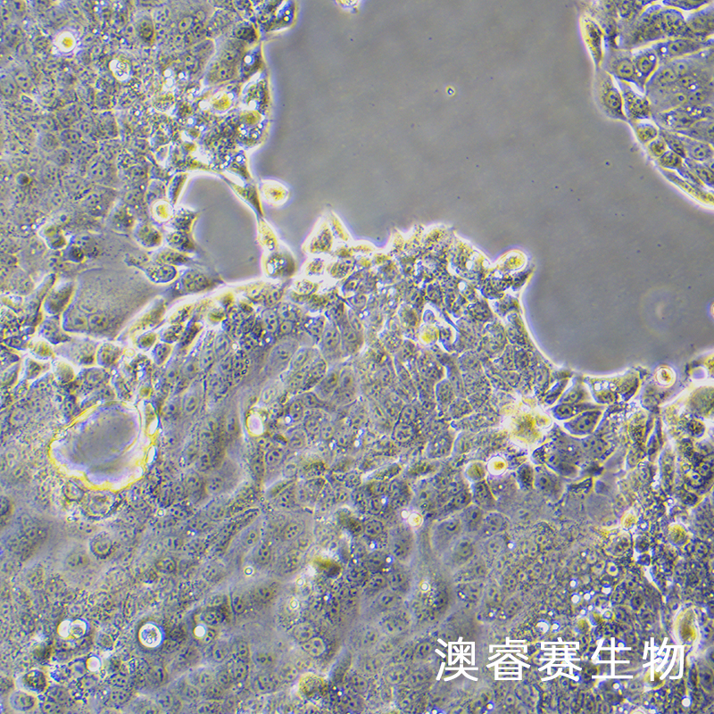 OE-33（人食管腺癌细胞）