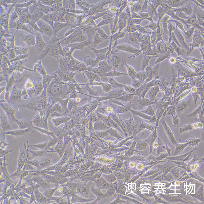 MO3.13（人少突胶质细胞）