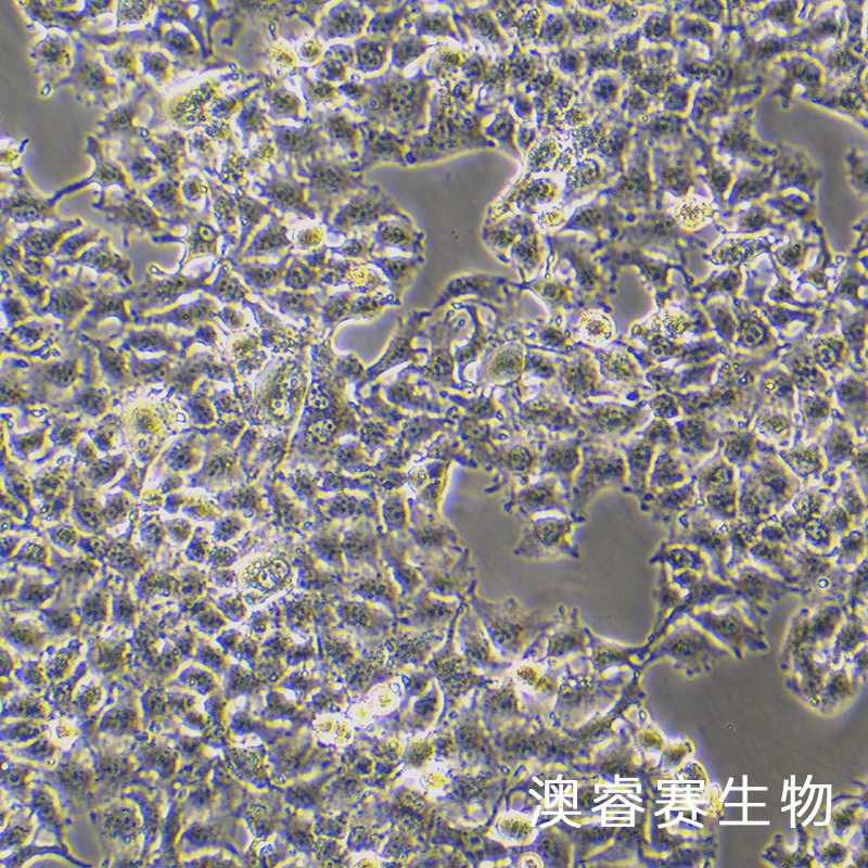 huh-7.5.1（人肝癌细胞）