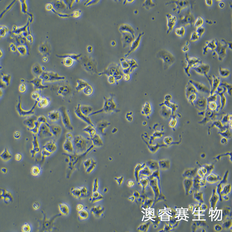 DMS-114（人小细胞肺癌细胞）