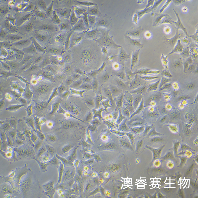 KYSE-520（人食管鳞癌细胞）