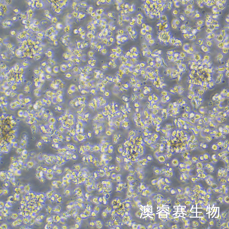 SU-DHL-1（人间变性大细胞淋巴瘤细胞）