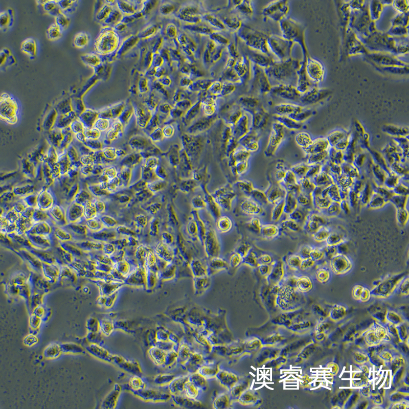 SUM159PT（人乳腺癌细胞）