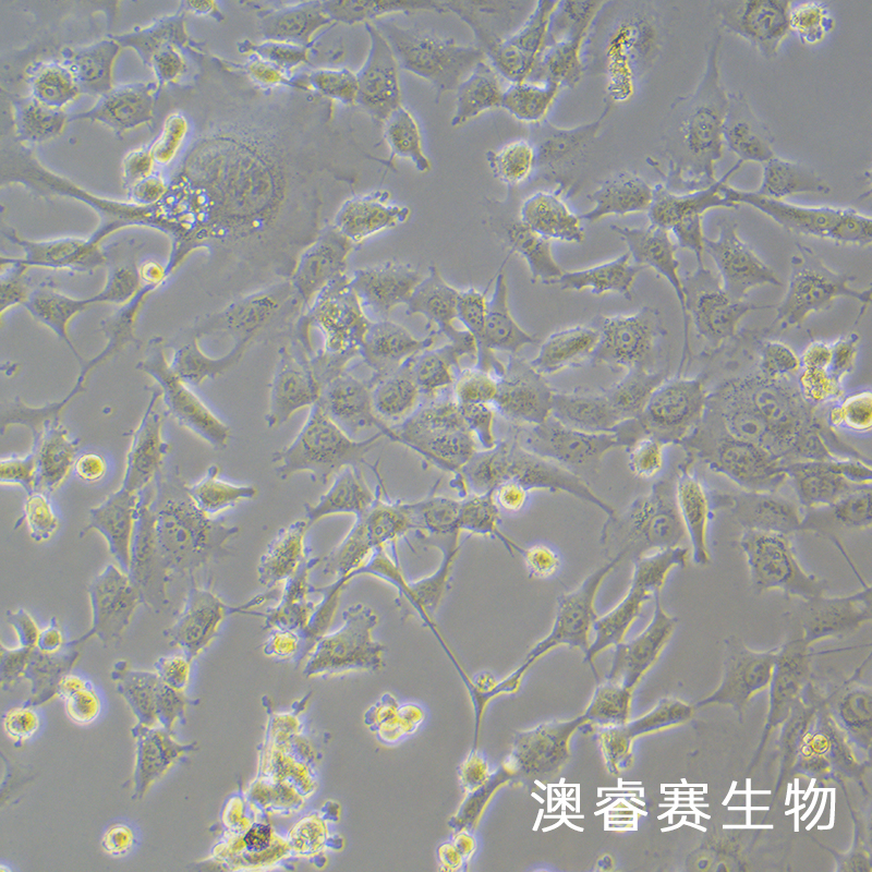 HEY A8（人卵巢癌细胞）