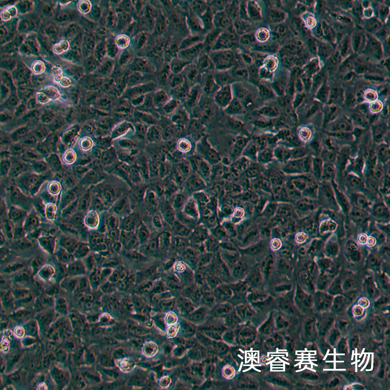 Ovcar 8（人卵巢癌腺癌细胞）