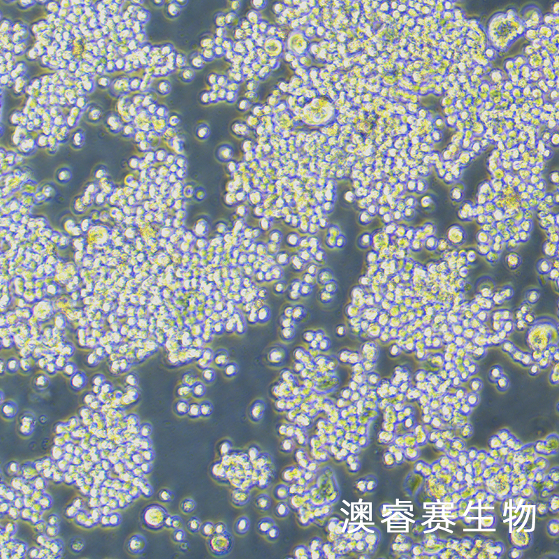 COLO320（人结肠腺癌细胞）
