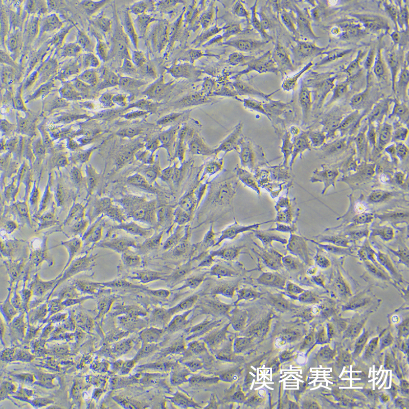 KGN（人卵巢颗粒细胞）