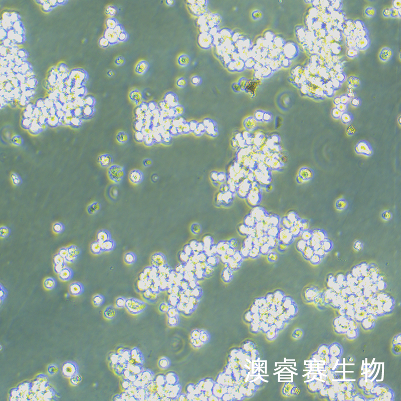 Hut-102（人T淋巴瘤细胞）