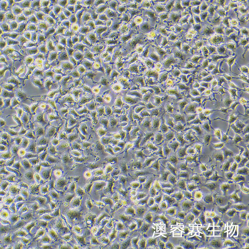 EpH4-Ev（小鼠乳腺上皮细胞）