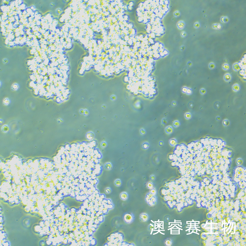 SHP-77（人小细胞肺癌细胞）