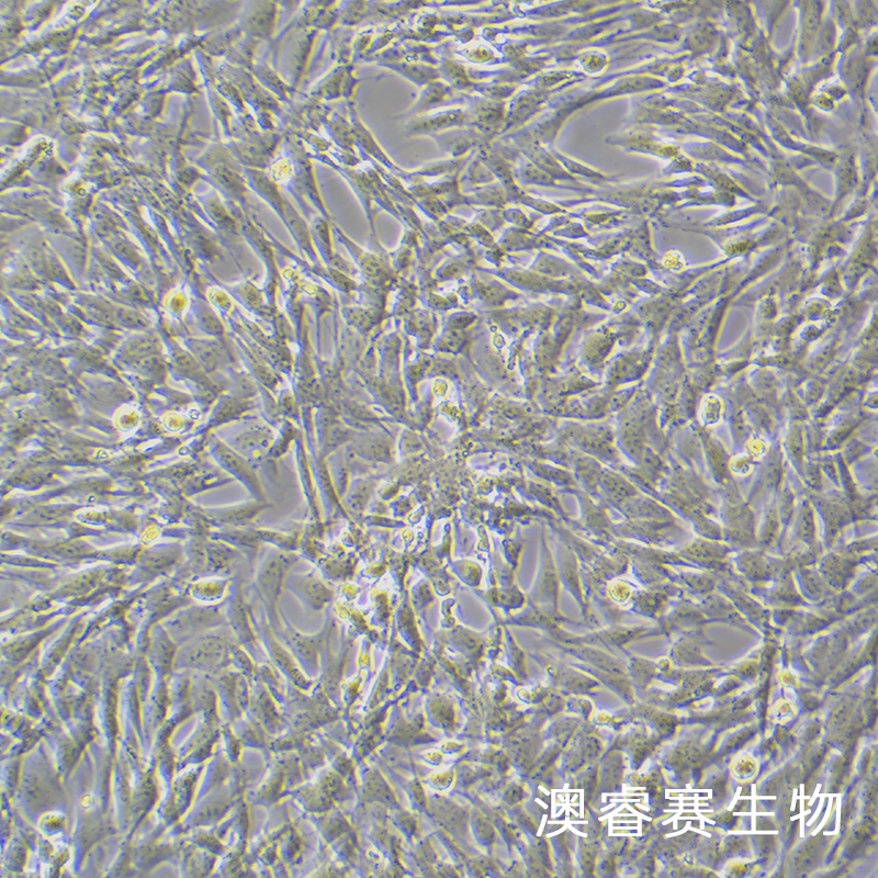 MOVAS（小鼠主动脉血管平滑肌细胞）