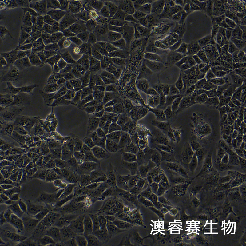 NTERA-2 cl.D1（人睾丸癌细胞）