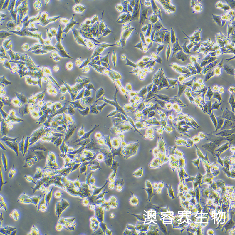 SNU398（人肝癌细胞）