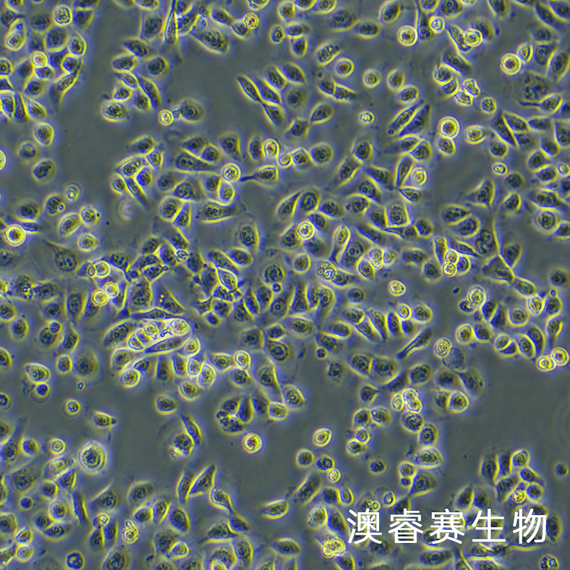 HEEC（人正常食管上皮细胞）