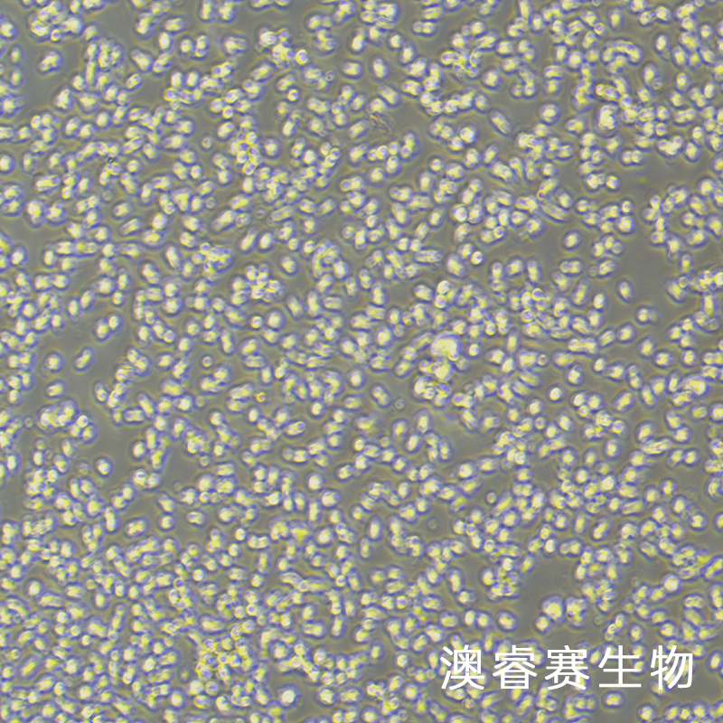 MEC-1（人慢性B细胞白血病细胞）