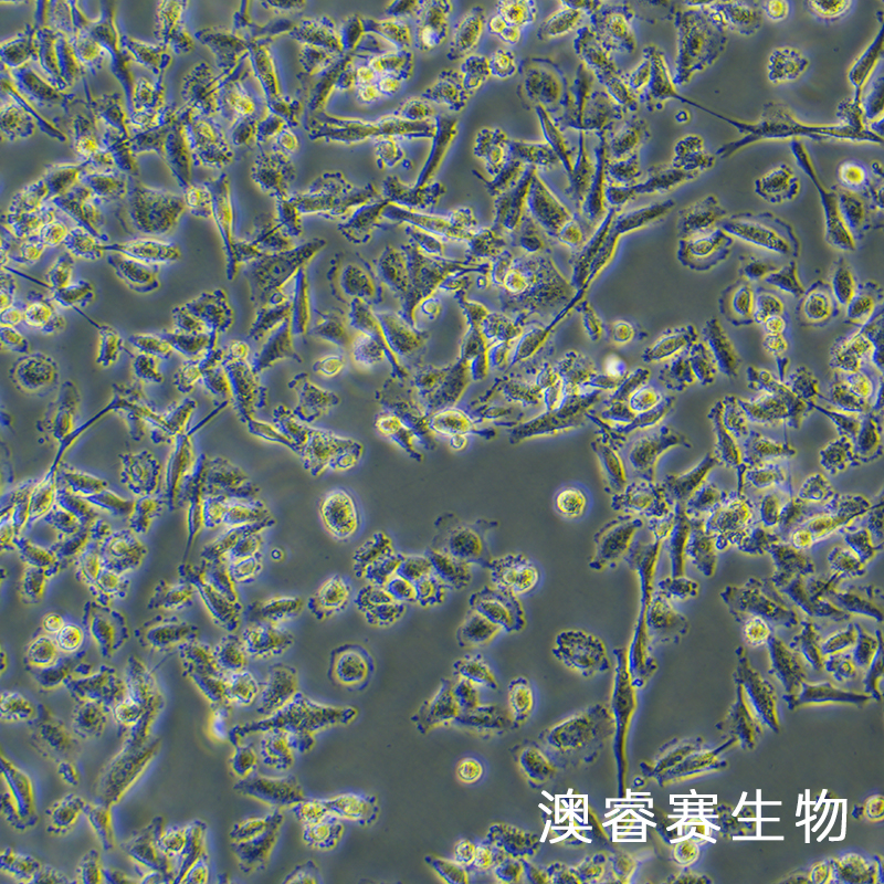 SW 756（人子宫鳞状癌细胞）