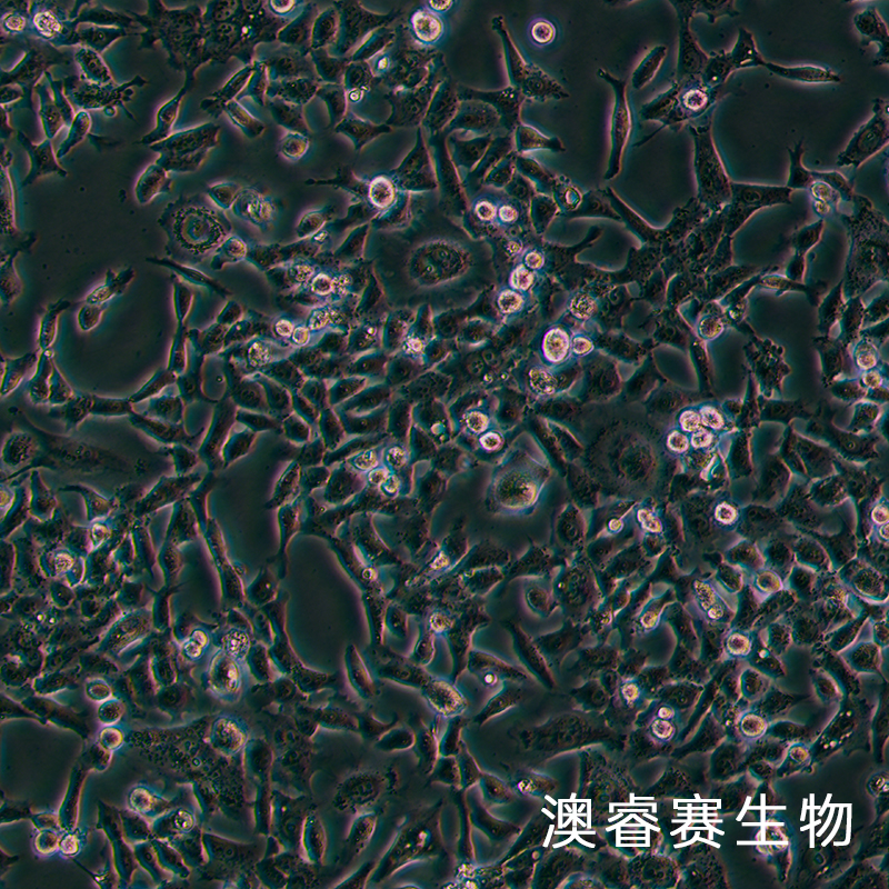 HCC1806（人乳腺鳞状癌细胞（三阴性））