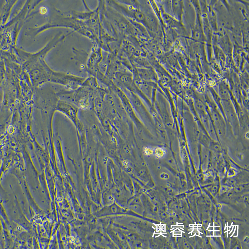 HTMC（人眼小梁网细胞）