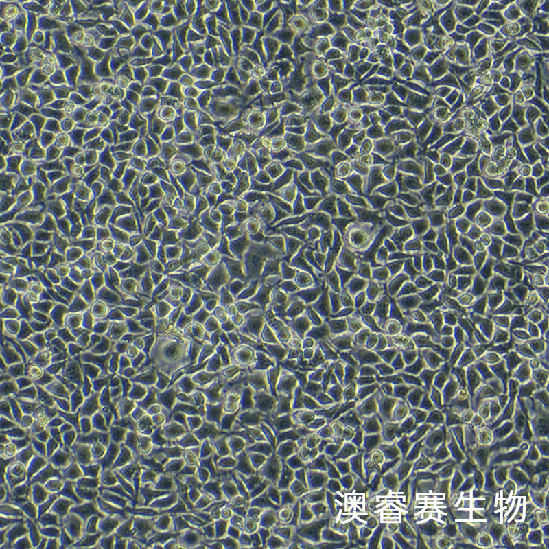 DRG（大鼠背根神经节细胞）