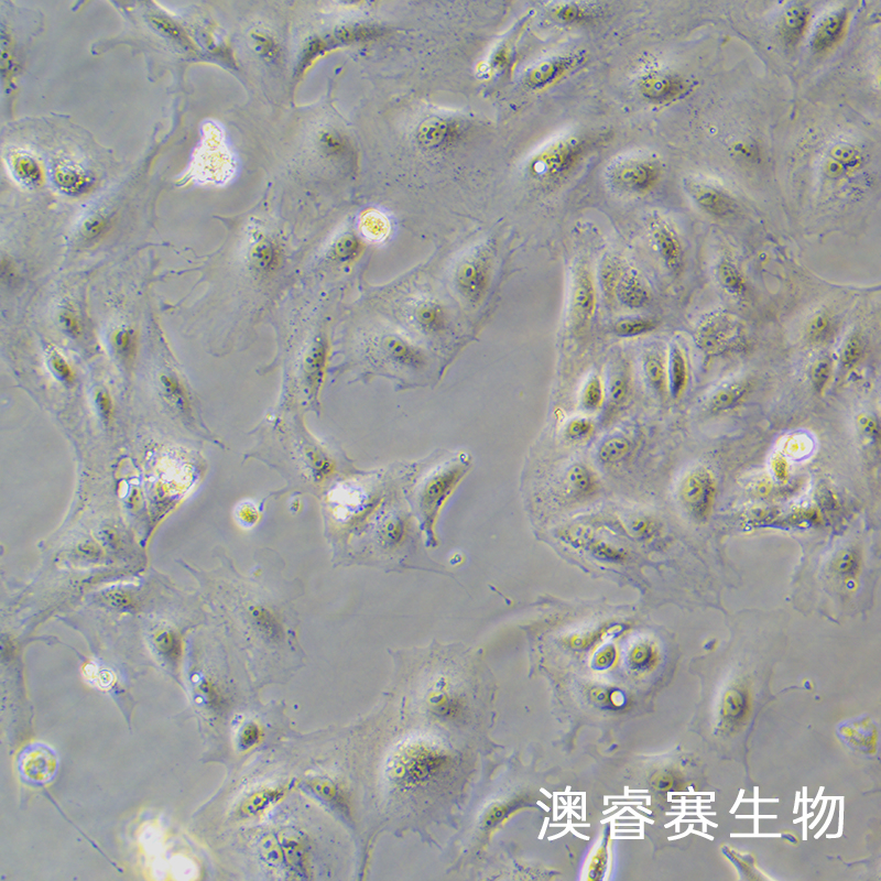 SNU-182（人肝癌细胞）