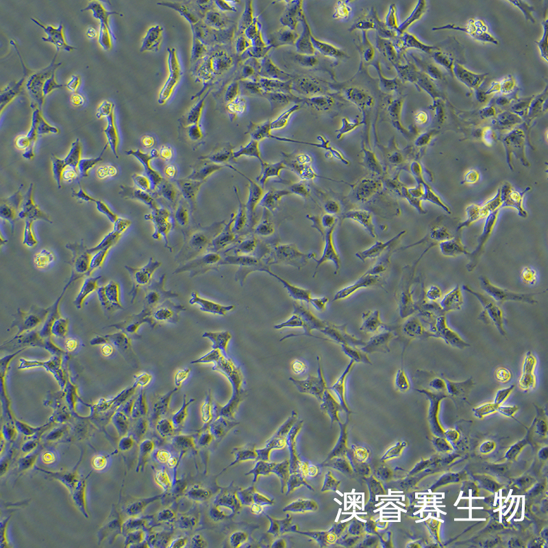 HMC（人肾小球系膜细胞）