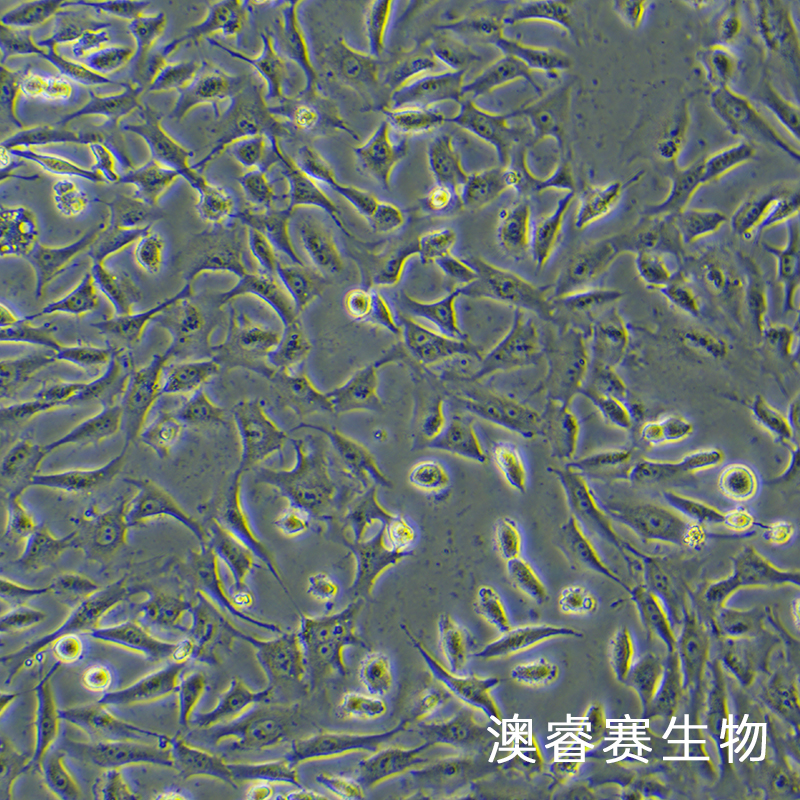 hRMECs（人视网膜微血管内皮细胞）