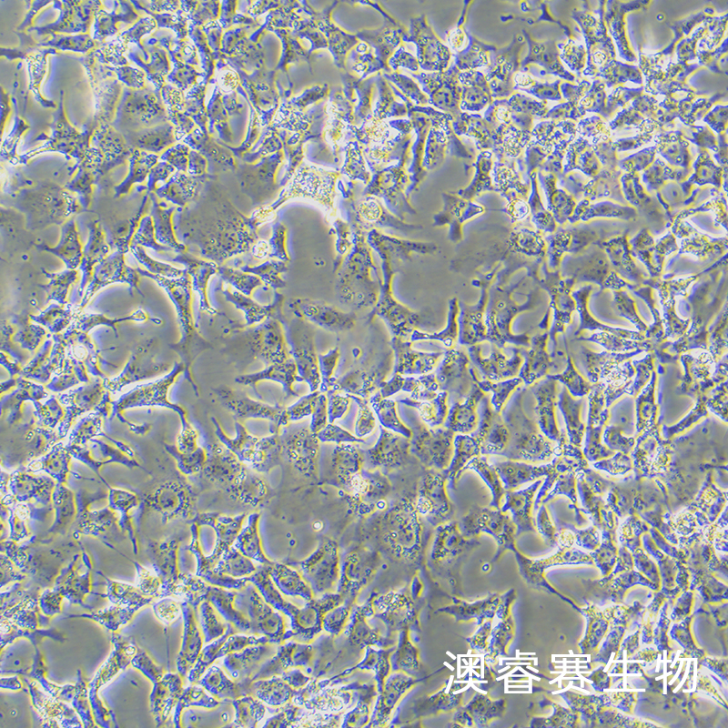 Hep3B（人肝癌细胞）
