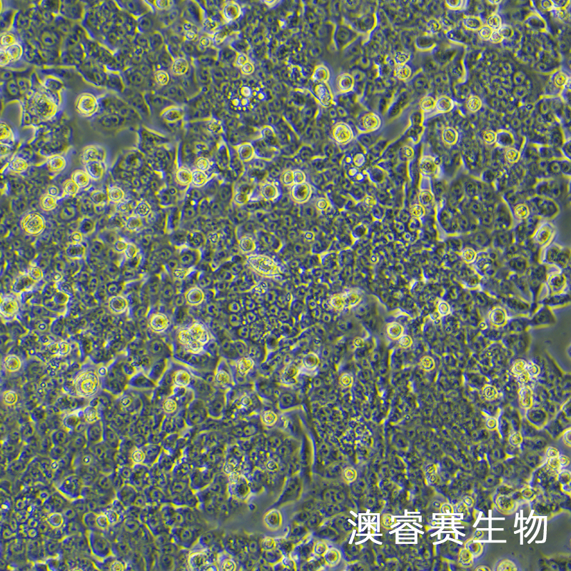 HCT-116（人结肠癌细胞）