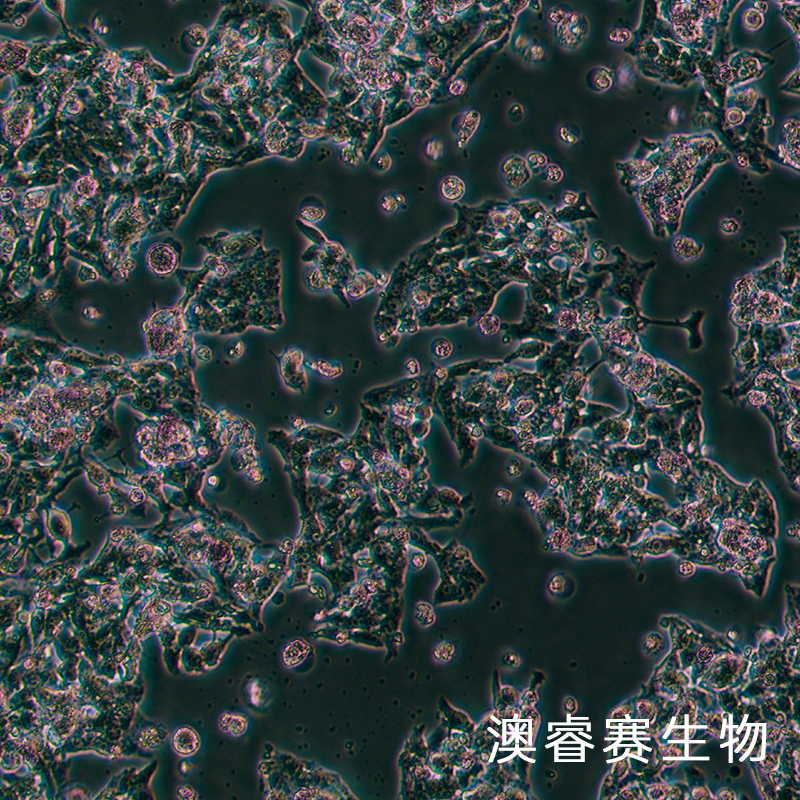 Hep G2（人肝癌细胞）