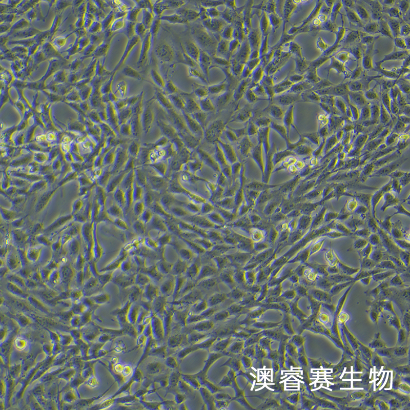 小鼠肺动脉内皮永生化细胞