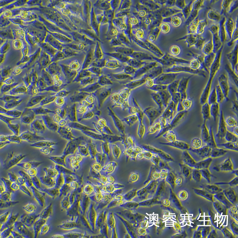 GIST-T1（人胃肠道间质瘤细胞）